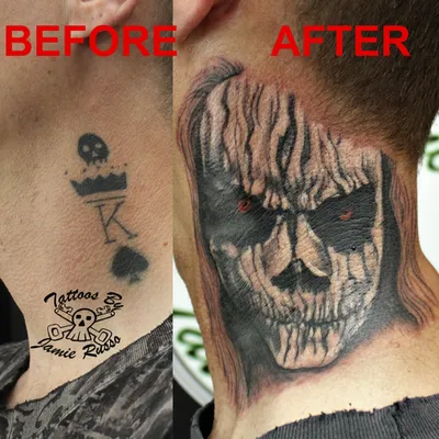 Skull cover-up tattoo