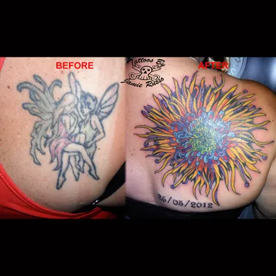Flower cover-up tattoo